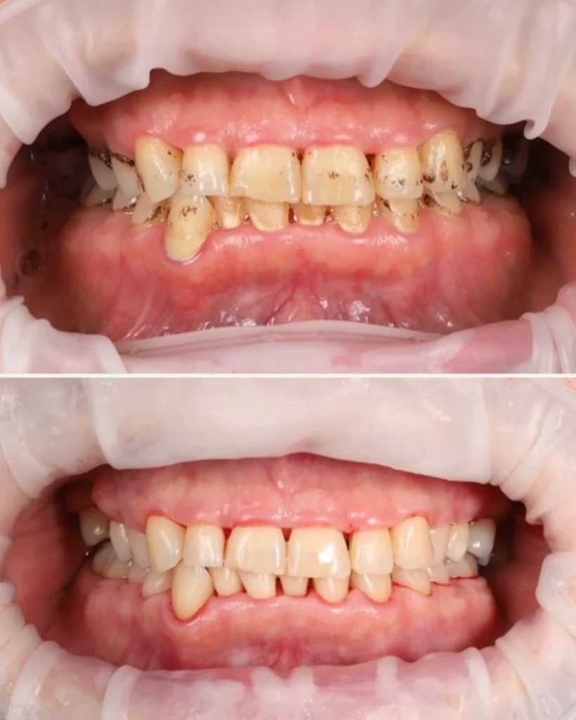 dental hygiene